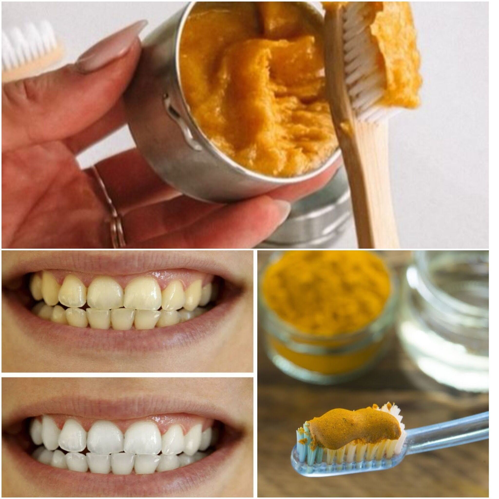 Learn about the natural wonder that turmeric may do for your dental health.