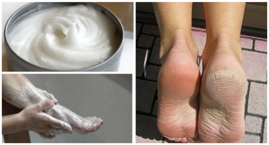 Here’s how to do a pedicure at home with baking soda.